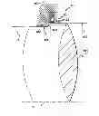 Fig. 01 - Ring for mounting a structure to a shaft