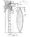 Fig. 04 - Ring for mounting a structure to a shaft