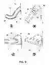 Fig. 08 - Portable device to compress bows