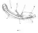 Fig. 08 - Laryngeal mask