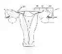 Fig. 01 - MINIMALLY INVASIVE DELIVERY DEVICES AND METHODS