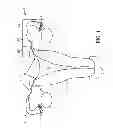 Fig. 02 - MINIMALLY INVASIVE DELIVERY DEVICES AND METHODS