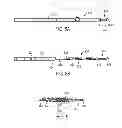 Fig. 09 - MINIMALLY INVASIVE DELIVERY DEVICES AND METHODS