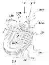 Fig. 01 - SLEEP APNEA RELIEF SYSTEM