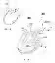 Fig. 03 - SLEEP APNEA RELIEF SYSTEM