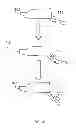Fig. 04 - SLEEP APNEA RELIEF SYSTEM