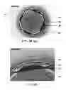 Fig. 07 - Surface improvement on electric discharge machined titanium alloy miniature parts for implantable medical device