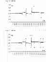 Fig. 07 - Method for selecting pipetting parameters for a liquid