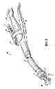 Fig. 03 - Seal element for anastomosis