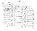 Fig. 01 - Bioabsorbable polymer, non-bioabsorbable metal composite stents