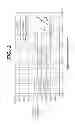 Fig. 03 - Bioabsorbable polymer, non-bioabsorbable metal composite stents