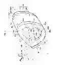 Fig. 02 - Airbag device