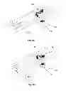 Fig. 06 - Transcutaneous power transmission utilizing non-planar resonators