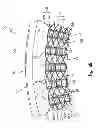 Fig. 07 - Electric machine with insulator spacer