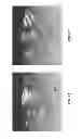 Fig. 08 - SINGLE-MODE OPTICAL FIBER-BASED ANGLE-RESOLVED LOW COHERENCE INTERFEROMETRIC (LCI)(A/LCI) AND NON-INTERFEROMETRIC SYSTEMS AND METHODS