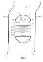 Fig. 02 - System and Method for Capsule Camera with On-Board Storage