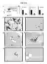 Fig. 07 - Modulation of BCL11A for treatment of hemoglobinopathies