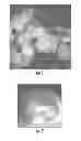 Fig. 02 - Hyperthermia therapeutic agent delivery system