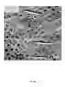 Fig. 06 - Methods and compositions to improve mechanical resistance of teeth