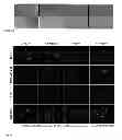 Fig. 02 - Cancer therapy via selective uptake of specialized nanoparticles in cancer cells