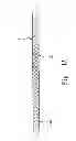 Fig. 02 - METHOD FOR MANUFACTURING FABRICS WITH ARTICIFICAL LEATHER TEXTILE FEELING