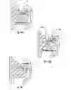 Fig. 08 - Orthodontic bracket
