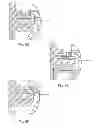 Fig. 09 - Orthodontic bracket