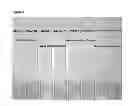 Fig. 04 - Method and device for combined detection of viral and bacterial infections