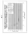 Fig. 02 - DOSAGE FORMS OF ELINOGREL AND METHODS OF INJECTABLE ADMINISTRATION THEREOF