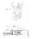 Fig. 02 - Catheter with bendable tip