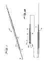 Fig. 02 - Guidewire with adjustable stiffness
