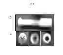 Fig. 09 - Minimally invasive surgical applicator