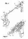 Fig. 02 - Surgical retrieval apparatus