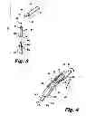 Fig. 03 - Surgical retrieval apparatus