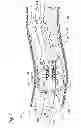 Fig. 06 - Rapid exchange fluid jet catheter