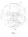 Fig. 02 - Device and system for gastric volume reduction to facilitate weight loss