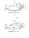 Fig. 02 - Method and System for Patella Realignment