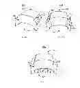 Fig. 06 - Method and System for Patella Realignment