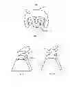 Fig. 07 - Method and System for Patella Realignment