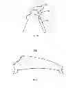 Fig. 08 - Method and System for Patella Realignment