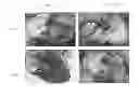 Fig. 01 - Joint repair using mesenchymal stem cells