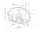 Fig. 02 - Tibial bearing component for a knee prosthesis with improved articular characteristics