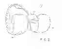 Fig. 06 - Tibial bearing component for a knee prosthesis with improved articular characteristics