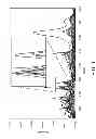 Fig. 02 - System for magnetic resonance spectroscopy of brain tissue for pattern-based diagnostics