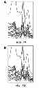 Fig. 08 - System for magnetic resonance spectroscopy of brain tissue for pattern-based diagnostics