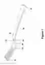 Fig. 02 - Utensils With Raised Working End When Resting