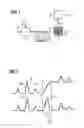 Fig. 02 - Method and arrangement for gas chromatographic analysis of a gas sample
