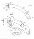 Fig. 01 - Tracheal tube with facility to view inner cannula