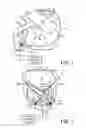 Fig. 02 - HELMET-TYPE OF PATIENT INTERFACE DEVICE AND METHOD USE
