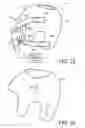 Fig. 09 - HELMET-TYPE OF PATIENT INTERFACE DEVICE AND METHOD USE
